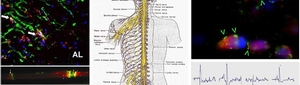 Neurology Clinic E